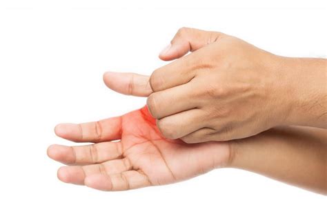 Itchy Palms 6 Causes Treatment And Prevention