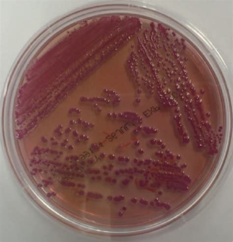 Lista 95 Foto Bacterias Que Crecen En Agar Macconkey Lleno