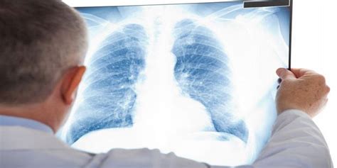Hidup dengan penyakit sangat mencabar khususnya bagi remaja yang sedang melalui perubahan fizikal dan psikologi yang mendadak. Mengetahui Perbedaan Bronkitis dengan Pneumonia : Okezone ...