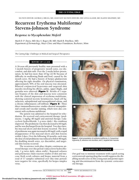 Pdf Recurrent Erythema Multiformestevens Johnson Syndrome Response
