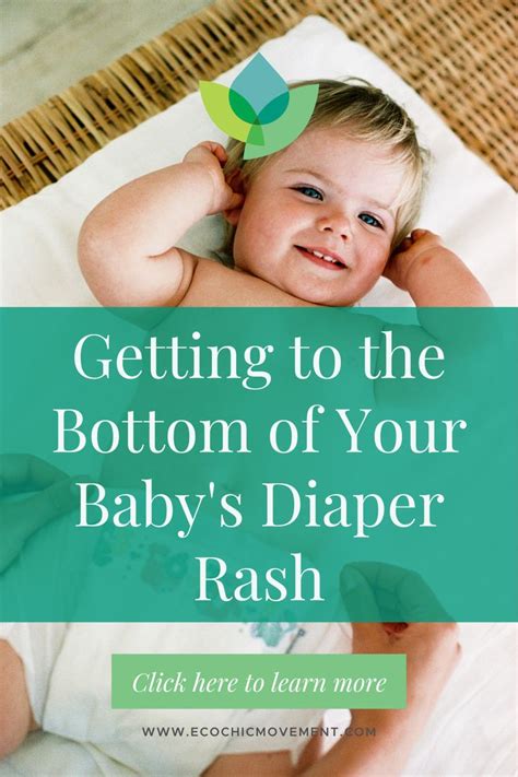 Getting To The Bottom Of Your Babys Diaper Rash Diaper Rash Baby