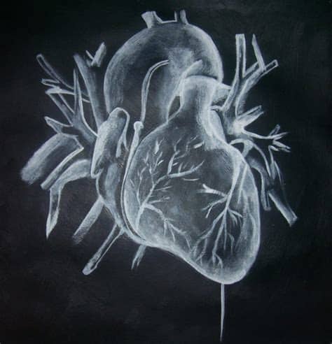 In fact every radiologst should be an expert in chest film reading. x-ray heart. by ChemicallyAbused on DeviantArt