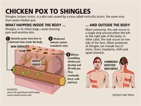 Although chicken pox symptoms in adults are similar to those exhibited by children, they tend to be more severe. What you need to know about shingles infections