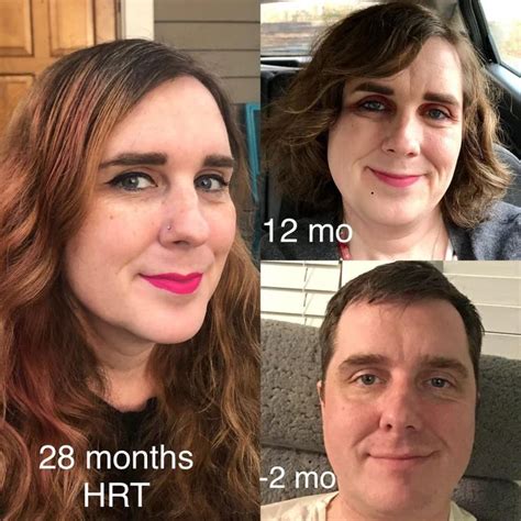 2 Years Of Hrt 38 Years Old Feels Like I Age In Reverse Now
