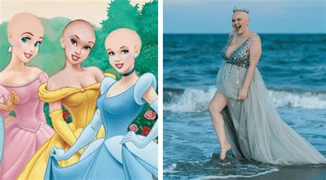 Cancer Fighter Wants Disney To Create A Bald Princess Inside The Magic