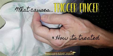 Trigger Finger In Rheumatoid Arthritis Rheumatoid Arthritis Warrior