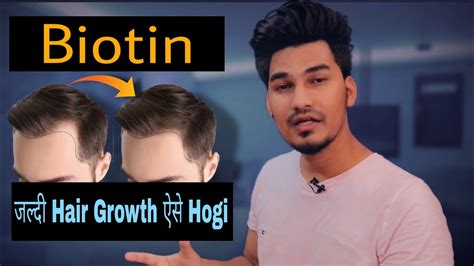 All of coupon codes are verified and tested today! Best Suppliment for healthy Hair 🔥 | biotin effects on ...