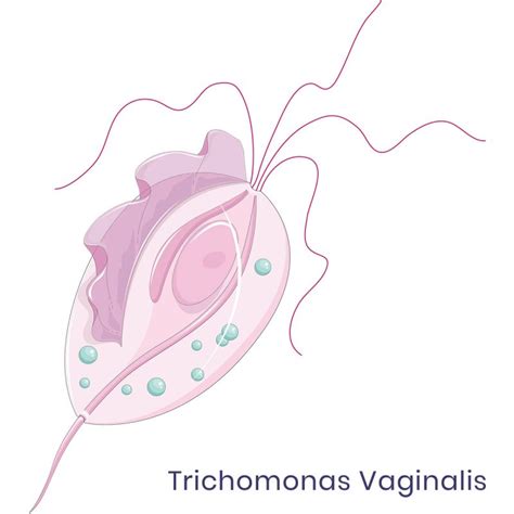 Trichomonas Vaginalis Symptoms Metromale Clinic Fertility Center
