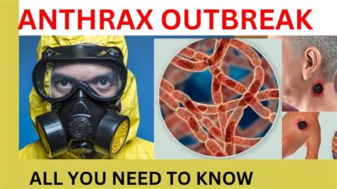 Latest Anthrax Disease Breakout Anthrax Mode Of Transmission Anthrax