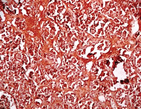 Immunohistochemical Stain In A Normal Pituitary Gland Stained For