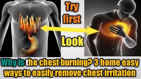 Why Is The Chest Burning 3 Home Remedies Easy Way To Remove The Chest