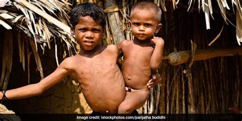 Concerted Efforts Can Make India Free From Malnutrition Experts