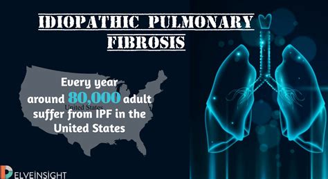 Idiopathic Pulmonary Fibrosis Scarring For A Lifetime Delveinsight