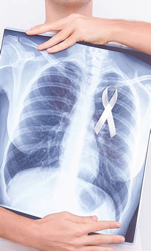 In most of the times wheezing is associated with various causes that can be easily treatable but it is also an early sign of lung cancer. 7 unusual signs of lung cancer tumors - Easy Health Options®