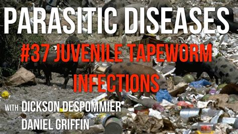 Parasitic Diseases Lectures 37 Juvenile Tapeworm Infections Youtube