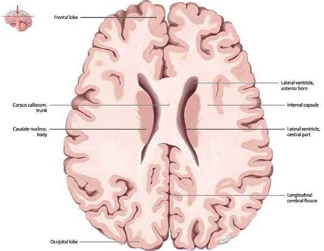 Brain Transverse Section Hot Sex Picture