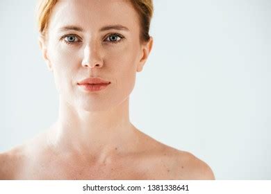 Naked Beautiful Woman Skin Illness Looking Foto Stock Editar Agora