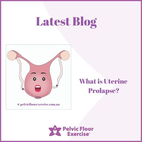 What Is Uterine Prolapse And How To Manage It With Physiotherapist