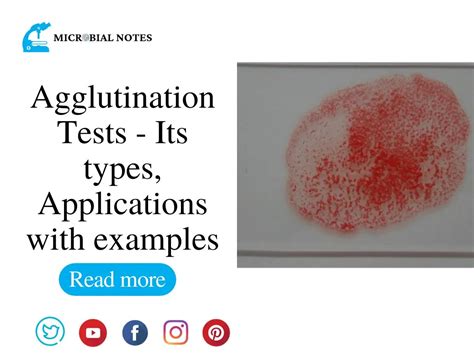 Agglutination Tests Its Types Applications With Examples Microbial Notes