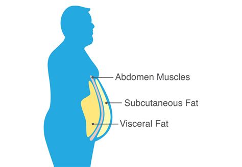 What Is Visceral Fat And Why It Is Dangerous Goqii