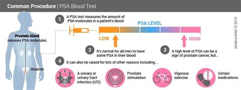 Prostate Specific Antigen Psa Test Results Accuracy Fasting Prep
