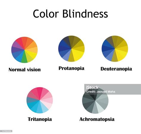 Color Blindness Typsnormal Visionprotanopiadeuteranopiatritanopia And Achromatopsiainfographic