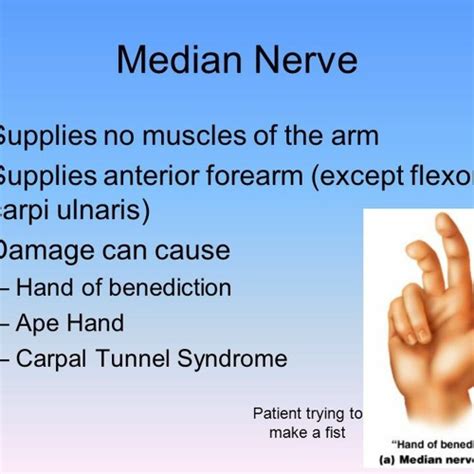 Stream Median Nerve Compression Treatmentmp3 By The Fitzmaurice Hand