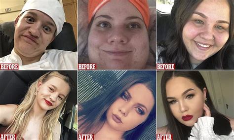 Women Have Shared Their Amazing Glow Ups In A Variety Of Before And