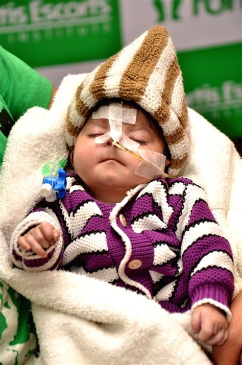 Baby Weighing 18 Kg Gets New Lease Of Life