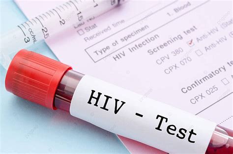 اختبار فيروس نقص المناعة البشرية المسمى أنبوب جمع الدم أنبوب عينة أنبوب