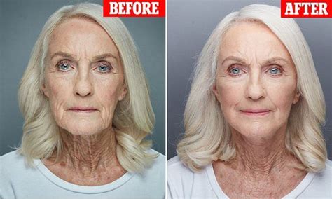 why this 80 year old great grandmother spent £10 000 on a face lift facelift 60 year old
