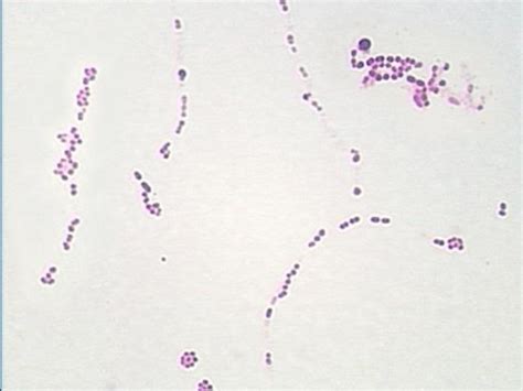 Gram Positive Cocci In Pairs Cloudshareinfo