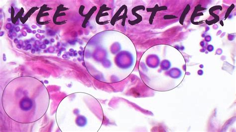 Yeast Skin Fungus Malasseziapityrosporum Incidental On Surface Of