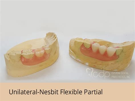 Flexible Partials Custom Dental Prosthetics Inc