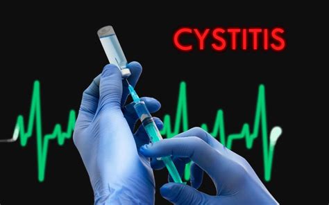 Pengertian Cystitis Apa Yang Dimaksud Cystitis Klinik Apollo