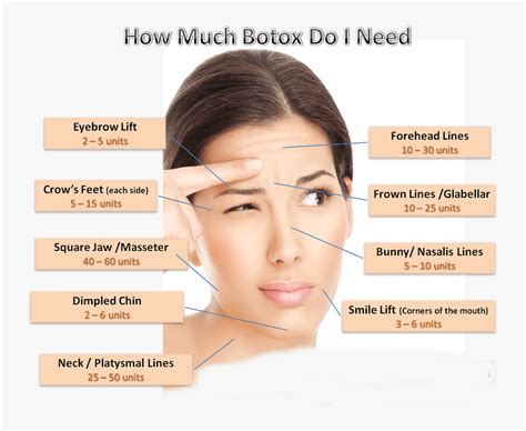 Botox Dose Chart