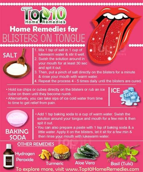 Blister Remedy Canker Sore Remedy Canker Sore On Tongue Remedies