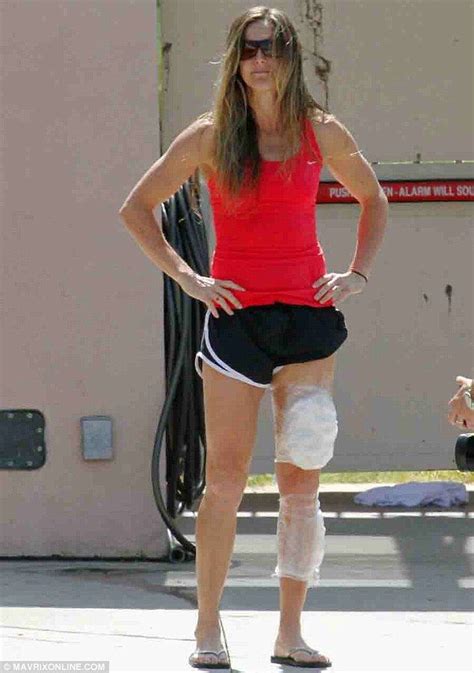 Brandi Chastain Injured Her Leg During A High Dive As She Practiced For