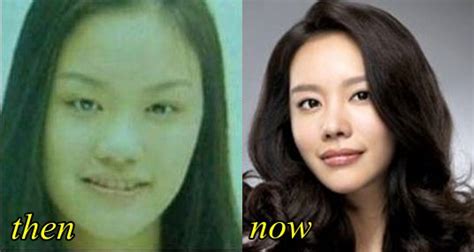 Kim Ah Joong Plastic Surgery Before And After Pictures Photos 2018