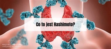 Co to jest Hashimoto Odżywiaj się zdrowo