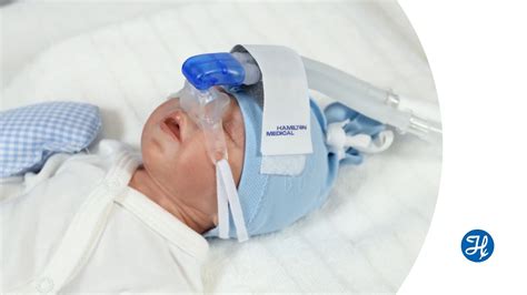 Que Es Cpap Neonatal Atenciones De Enfermeria En El Cpap Nasal Del Rn