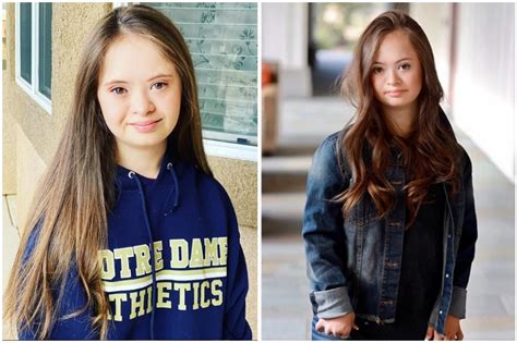 Teen Model with Down's Syndrome is Breaking Stereotypes ...