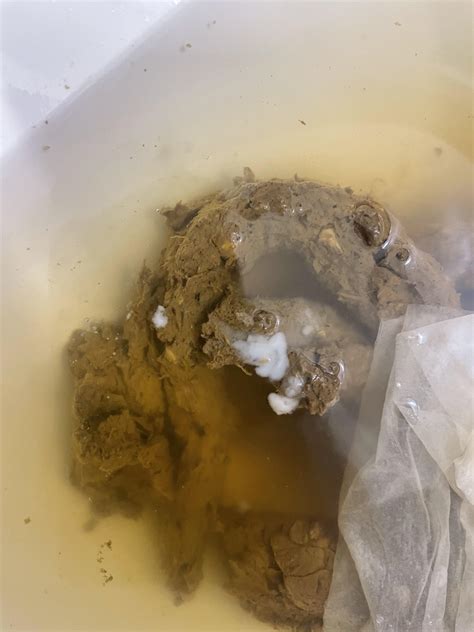 Bright White Mucus In Poop What Causes This Rshittingadvice