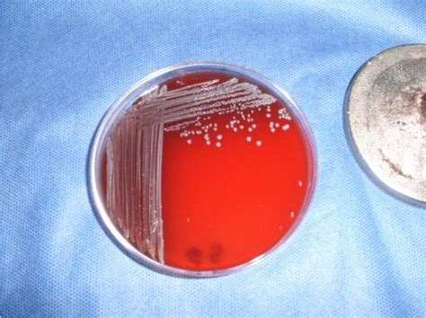 Staphylococcus Aureus Small Colony Variants In Blood Agar Download