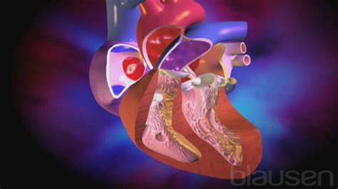 Congenital Heart Problems Patent Foramen Ovale Blausen