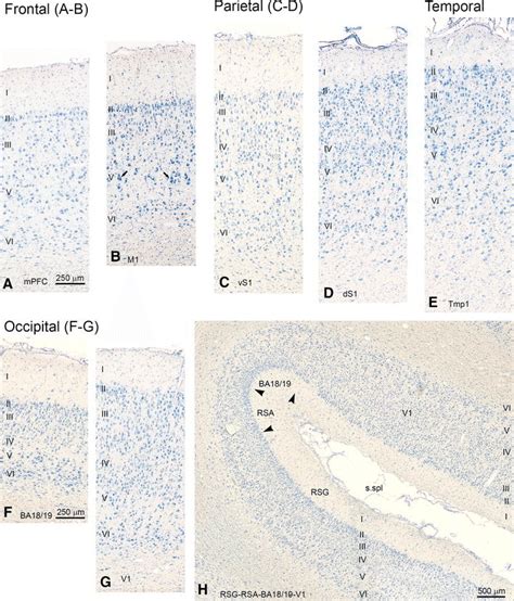 Microphotographs Of Selected Parts Of Nissl Stained Coronal Sections