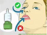 Flonase Nose Spray Side Effects