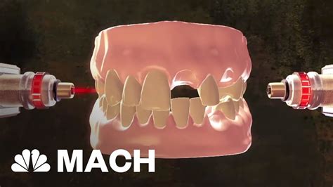 New Stem Cell Research Could Put An End To Dental Visits Mach Nbc