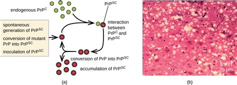 Viroids Virusoids And Prions Microbiology