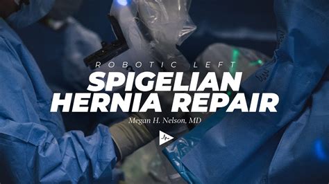 Robot Assisted Ventral Hernia Repair Spigelian Preview Youtube